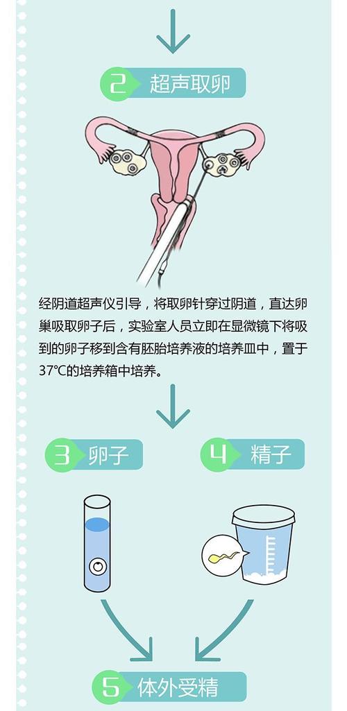 国内供卵试管代怀流程-国内供卵试管代怀流程解析