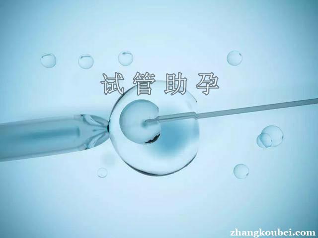 广东借卵试管_广东借卵试管：助力生育的新选择