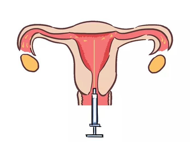 国内借卵试管代怀安全吗_国内借卵试管代怀安全吗？需要了解的安全问题大揭秘