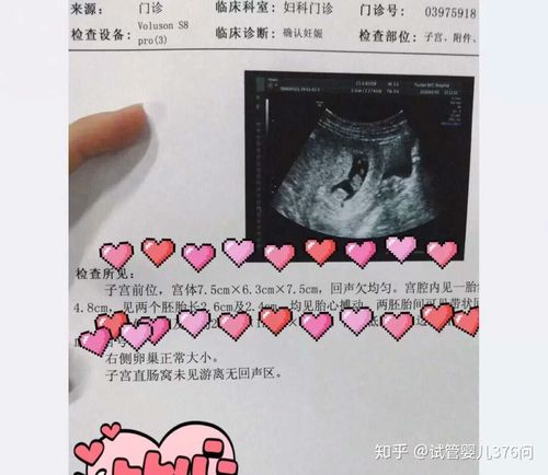 国内供卵试管代怀双胞胎【国内供卵试管代怀双胞胎:实现双胞胎梦想的最佳选择】