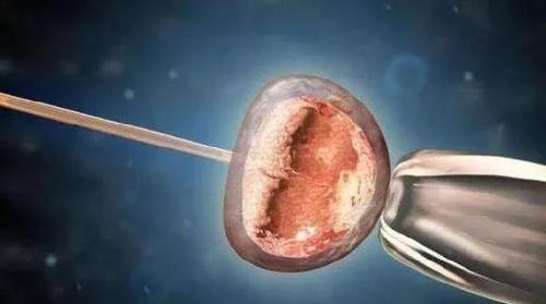 试管婴儿借卵(试管婴儿借卵:新生命的奇迹)