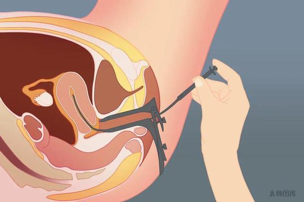 借卵试管代怀的女人【借卵试管代怀:她们的求子之路】